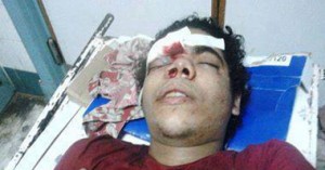 15 years old boy got tortured by Muslim Brotherhood in Rabaa Square