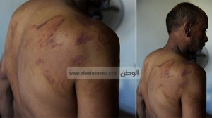 victims of rabaa square tortured by brotherhood
