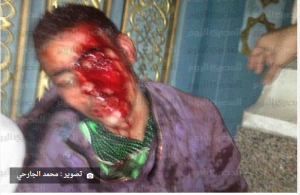 Egyptian citizen tortured inside the mosque in front of Etihadeya Palace by Muslim Brotherhood 4 December 2012
