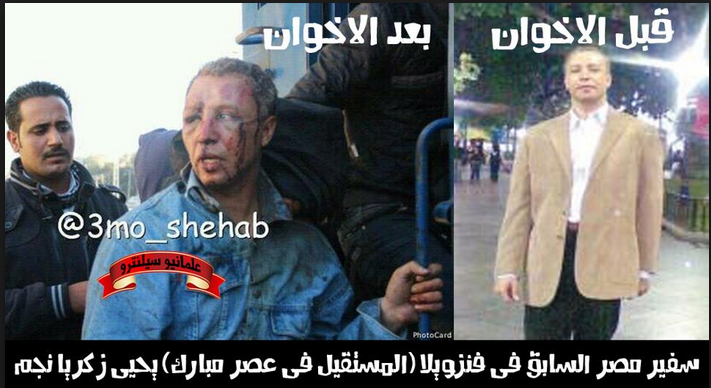 Former Ambassador of Egypt in Venezuela Yehia Zkaria Negm before and after he got tortured by Muslim Brotherhood in front of Etihadeya presidential palace 5 december 2012