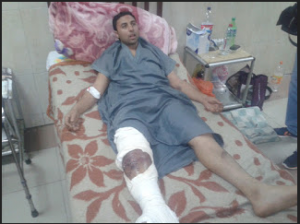 Karim Hassan victim of torture of Muslim Brotherhood militias tortured him in Mukatam area close to MB headquarter